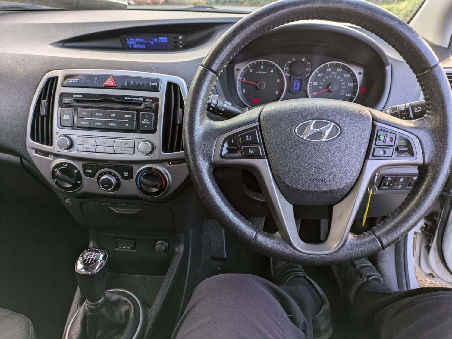 Hyundai i20 Listing Image